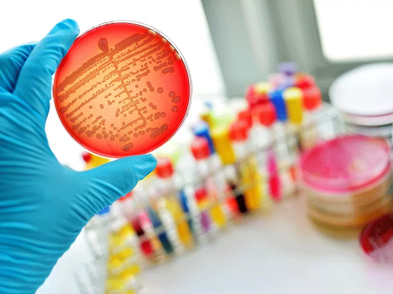 Gloved hand holding petri dish in lab Gloved hand holding petri dish in lab