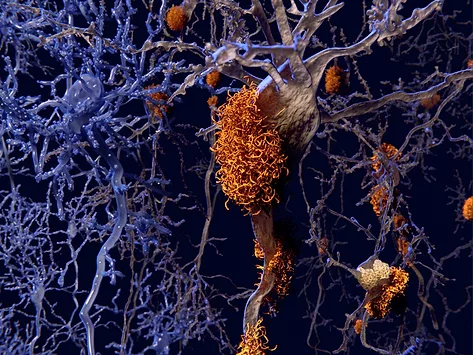 Tau neuron illustration