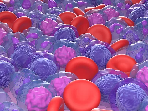 Aml acute myekoid leukemia cells