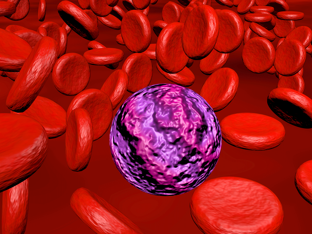 Acute myeloid leukemia illustration