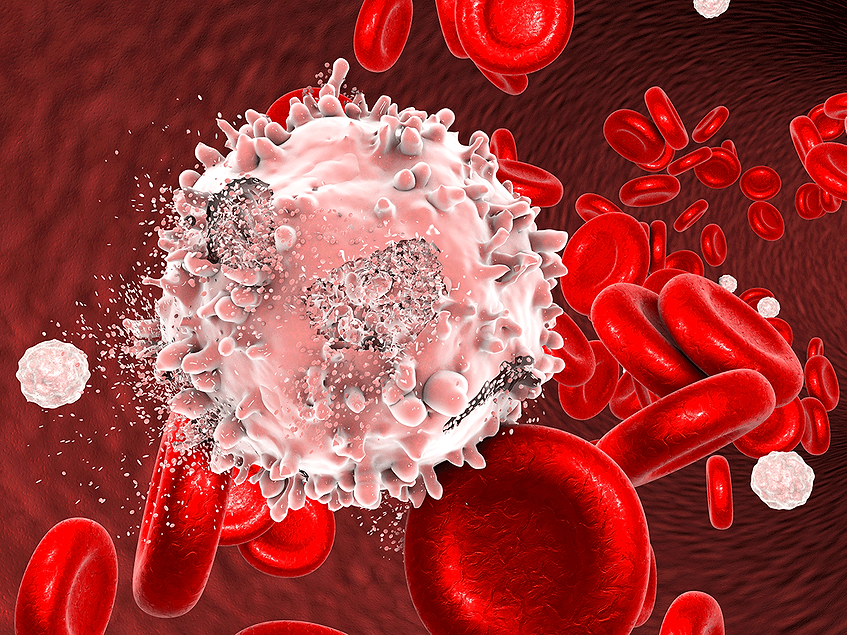 Elzonris this: FDA clears Abbvie's Decnupaz in BPDCN