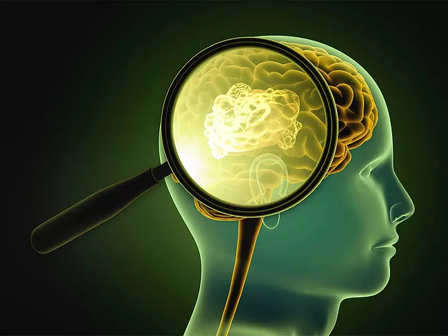 Illustration of magnifying glass looking at cancer in the brain