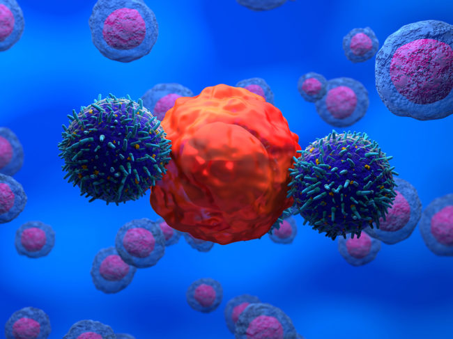 CAR T cells attacking cancer cell