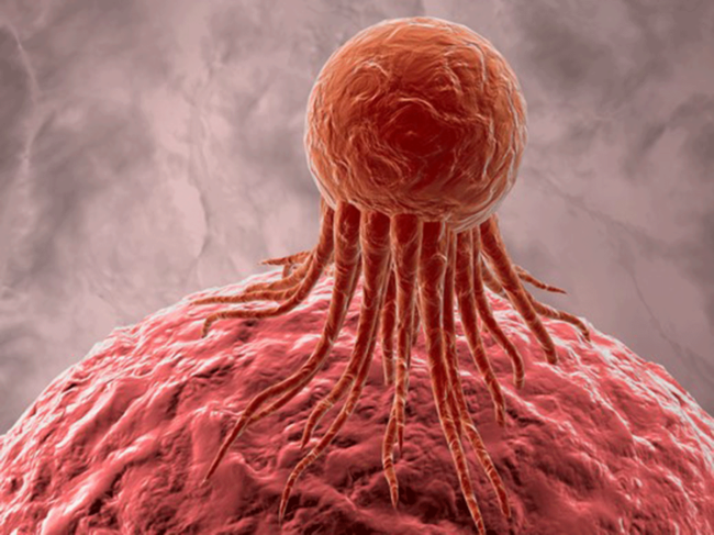 Cancer cell illustration