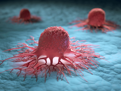 Cancer cells1