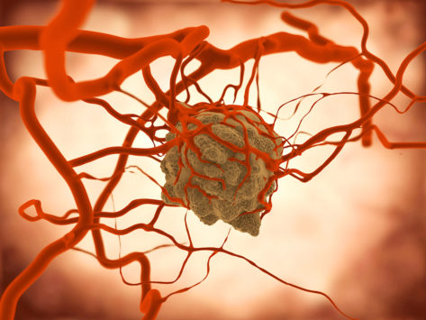 Cancer tumor blood vessels