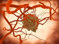 3D illustration of tumor