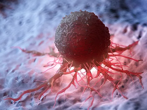 Cancer tumor illustration