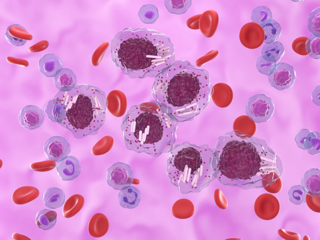 Illustration of chronic lymphocytic leukemia cells