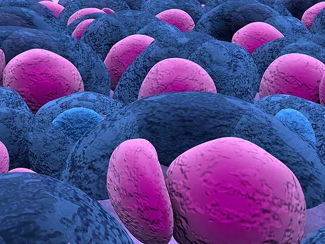 Multiple myeloma illustration