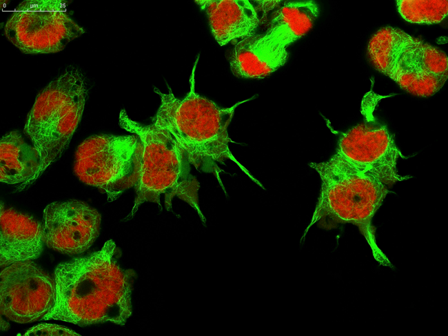 Real fluorescence microscopic view of human neuroblastoma cells