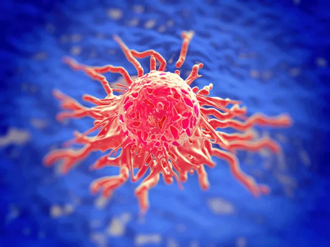 Cervical cancer cell