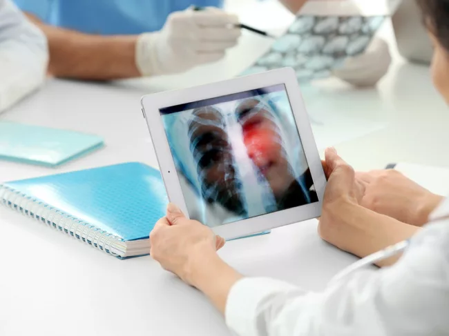 Doctors examining lung scans