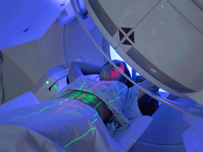 Woman receiving radiotherapy treatments for cancer