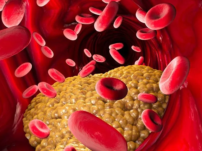 Artery, blood cells, triglycerides