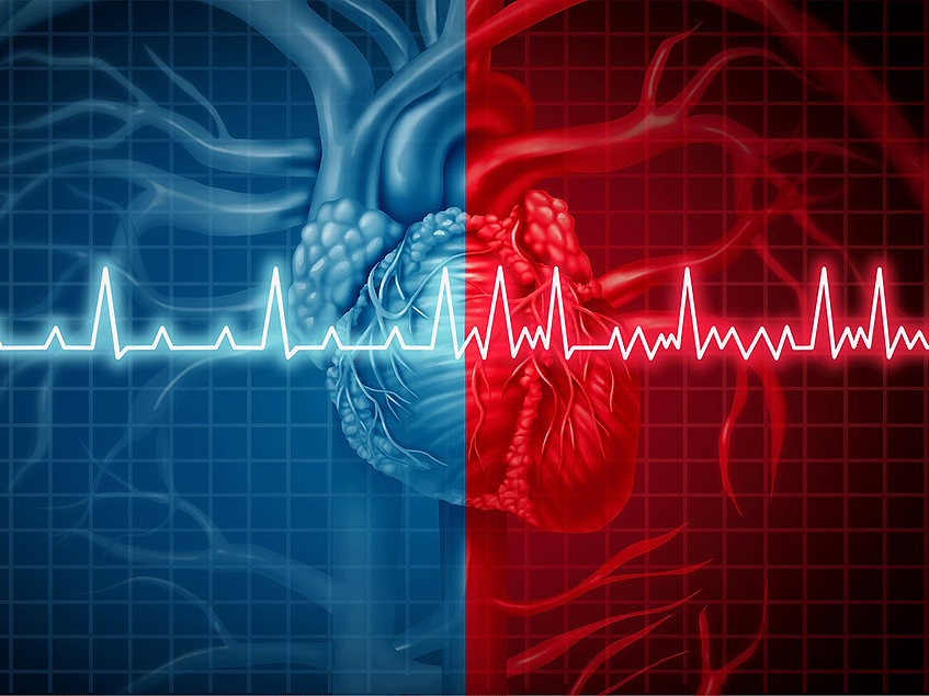 Med-tech companies highlight PFA data as competition intensifies