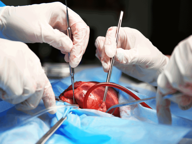 Heart surgery 