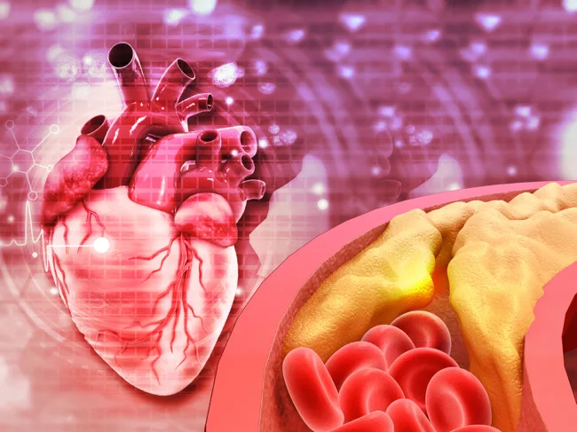 Heart with blocked blood vessel