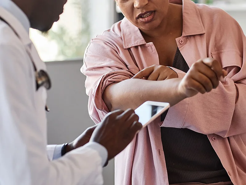 Takeda's zasocitinib bests Sotyktu in phase III psoriasis trial