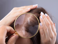 Hair and scalp under magnifying glass