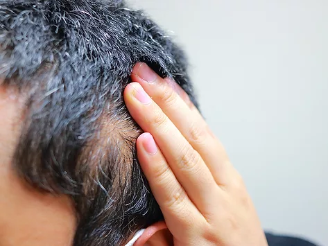 Hand showing bald patch of scalp