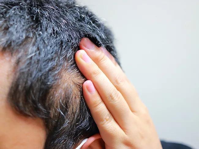 Hand showing bald patch of scalp