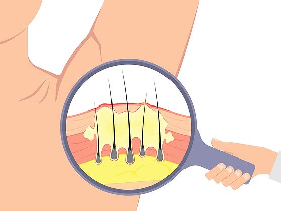 best time to take your glp 1 shot GLP-1 Injections for Medical Weight Loss Near Me best time to take your glp 1 shot GLP-1 Injections for Medical Weight Loss Near Me