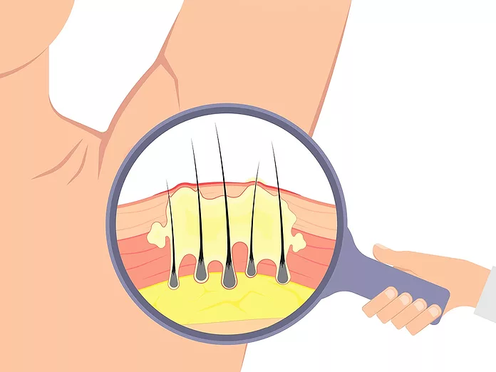 chinese glp 1 Ozempic craze hits China as first GLP-1 weight-loss drug is greenlighted –  The China Project