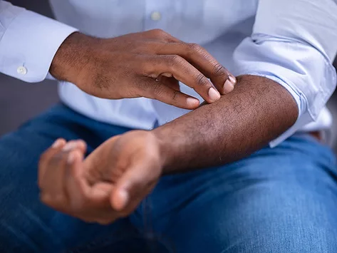 Man scratching arm2