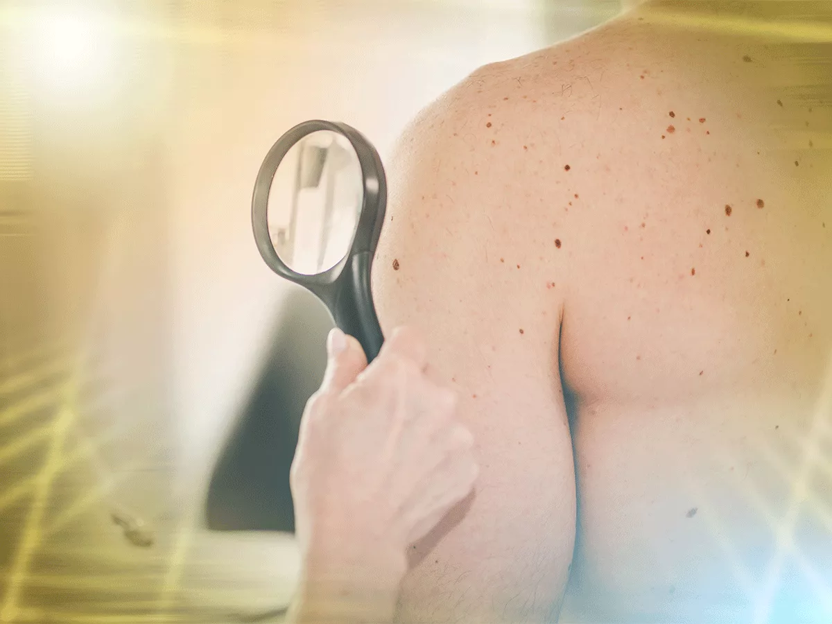 Rinascera launches with two rare genetic skin disease therapies