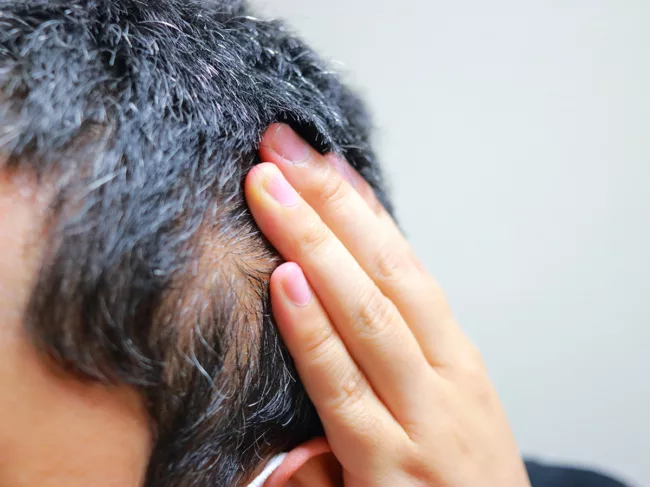 Hand showing bald patch of scalp