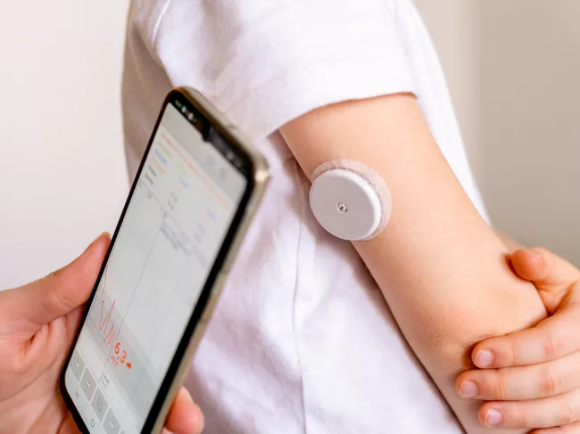 Glucose monitor on arm with smartphone