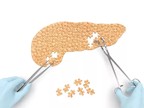 Pancreas puzzle