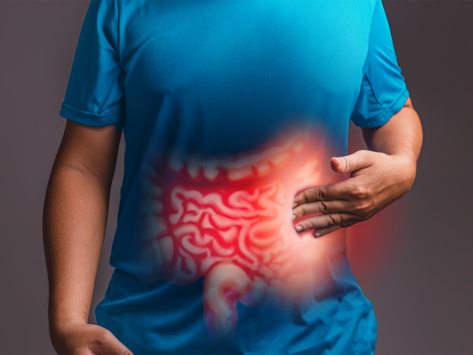 Illustration of intestines overlayed on human torso