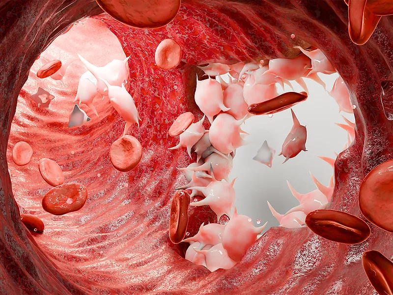 retatrutide death Significantly Reduces Visceral Fat in Clinical Trials Vial of unapproved peptide retatrutide