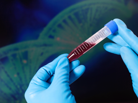 Blood sample, DNA