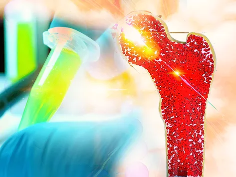 Lab sample and bone marrow illustration