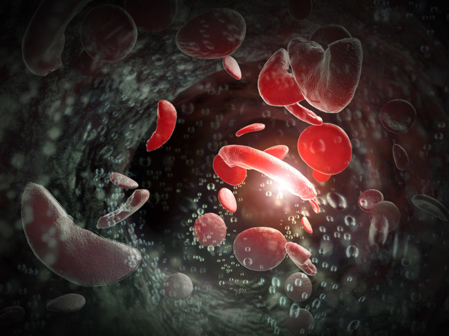 Sickle cell disease 3D illustration