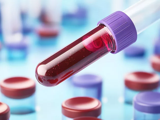 Liquid biopsy illustration