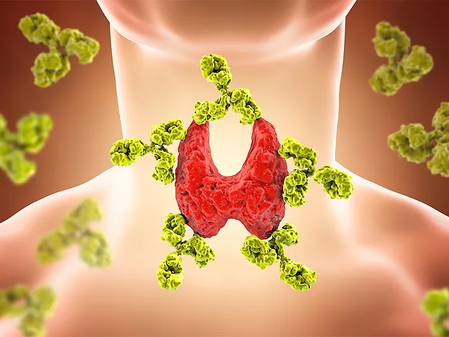Illustration showing antibodies attacking thyroid