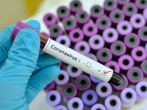 Coronavirus-test-tube