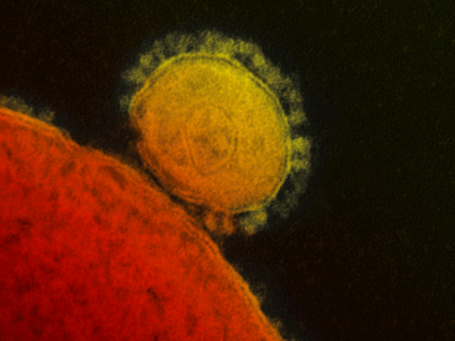Micrographic image of coronavirus