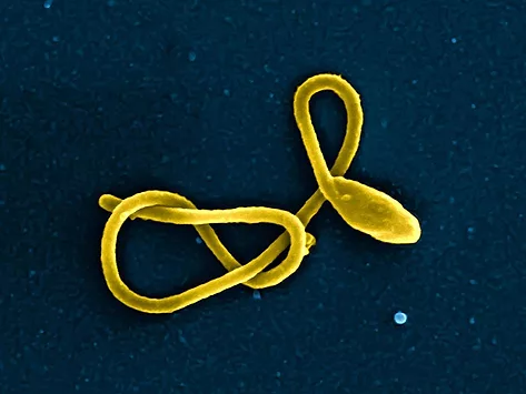 Ebola virus particle