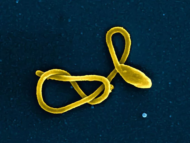Ebola virus particle