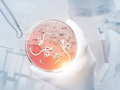 Ebola virus in petri dish with lab, scientist background