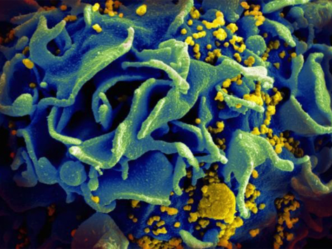 Hiv infected t cell