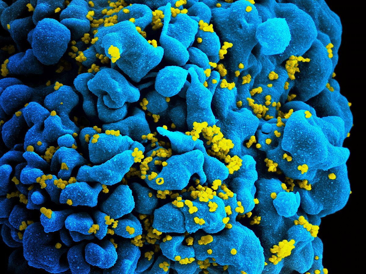 HIV infected cell
