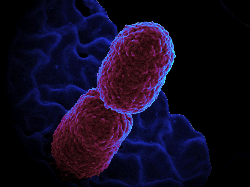 Stem cells can help stem Klebsiella infection 20201002 BioWorld