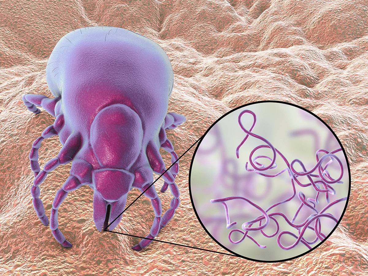 Lyme disease bacteria, Borrelia burgdorferi, transmitted by Ixodes tick