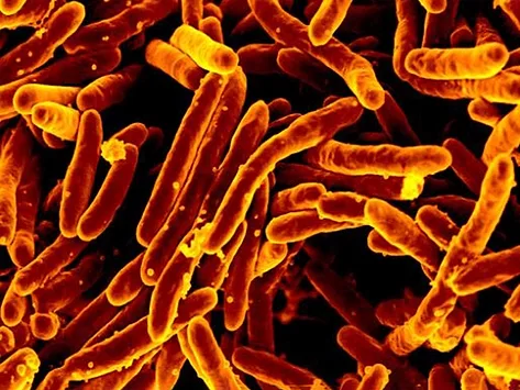 Mycobacterium tuberculosis